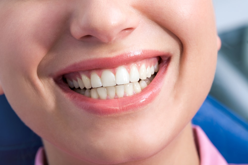 How Dental Fillings Save Your Teeth