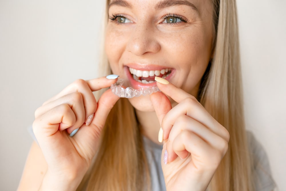 Invisalign 101: Everything You Should Know About It
