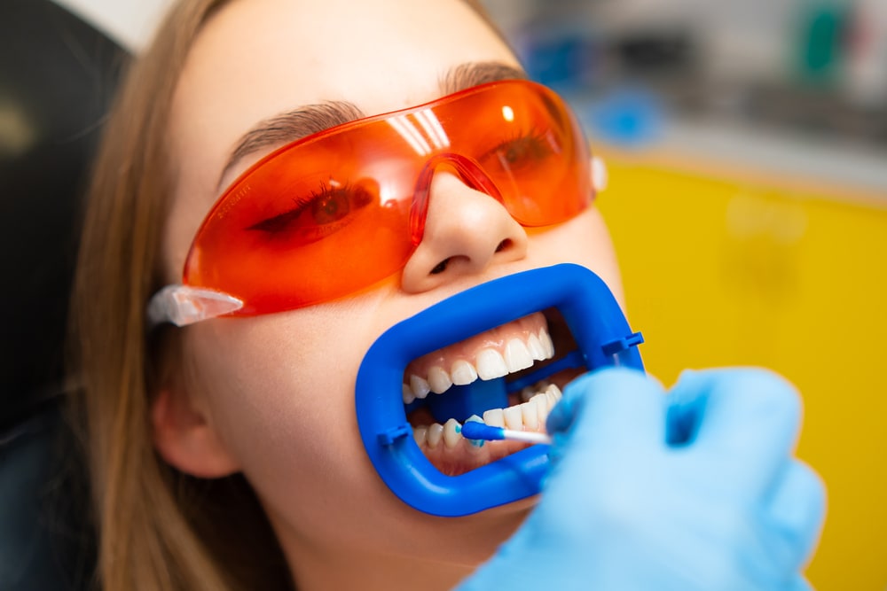 Dentist applies whitening gel to female patient, wearing orange protective goggles, teeth in the dental clinic