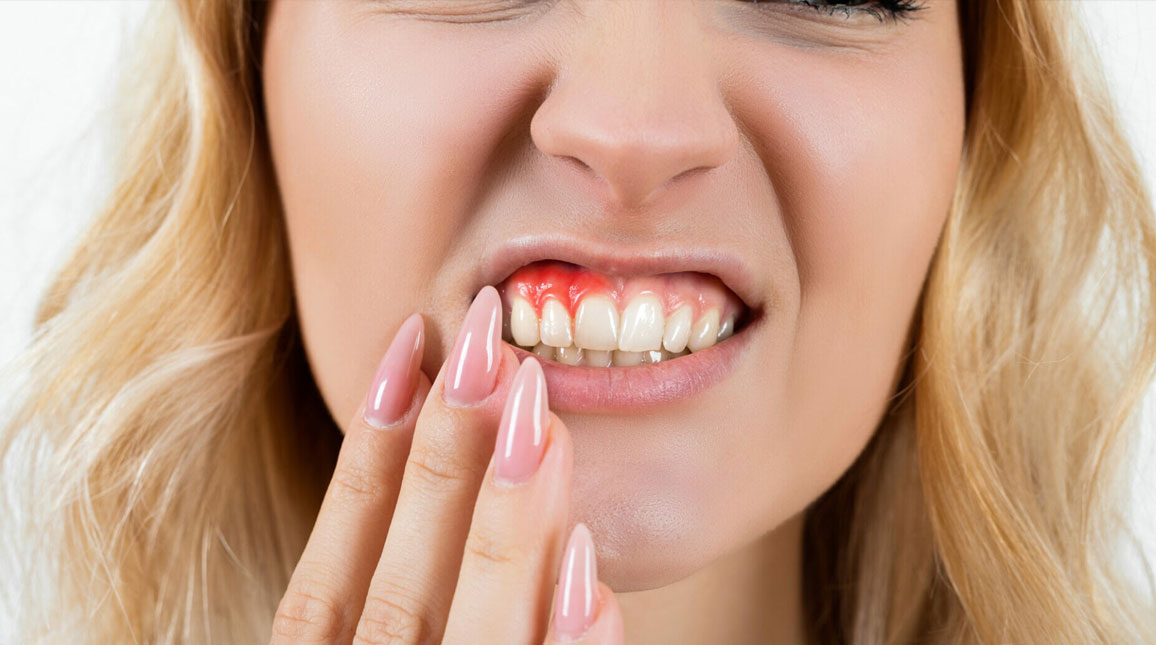 Receding Gums Treatment Early Signs, Causes, and How to Protect Your Smile